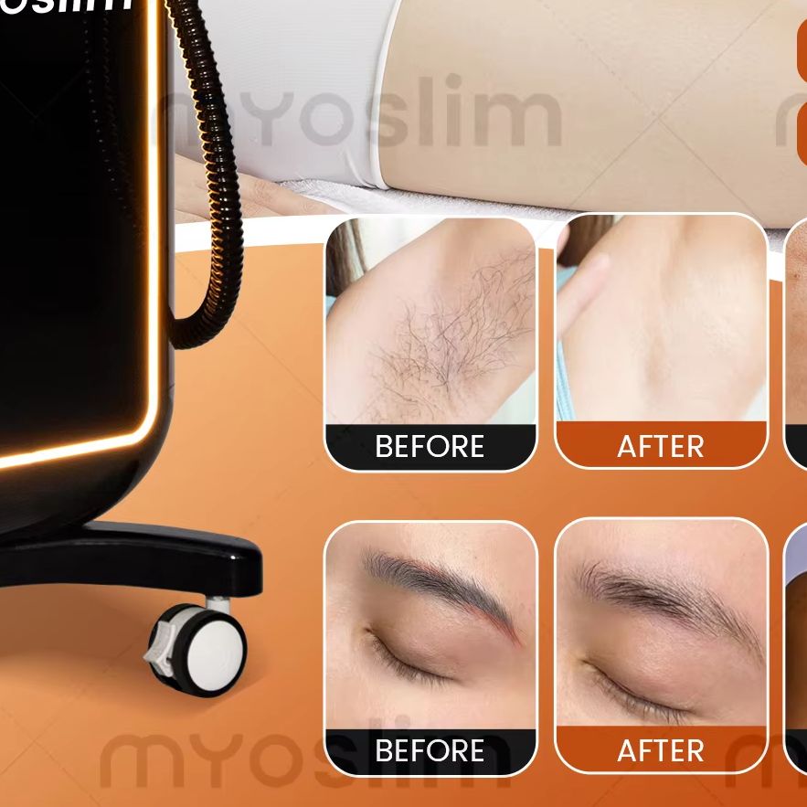 Hair Care Or Haircare - Multifunctional 4 IN 1 Diode Lase