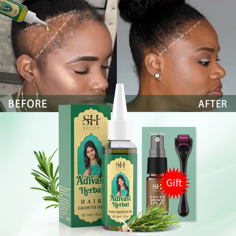Ayurvedic Hair Growth Oil Indi - Hair Care Fragrance Essential Oil review and price