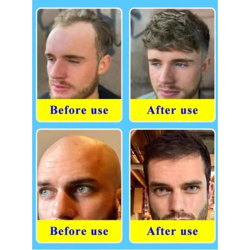 Biotin Collagen Hair Care Esse - Hair Care Collagen review and price