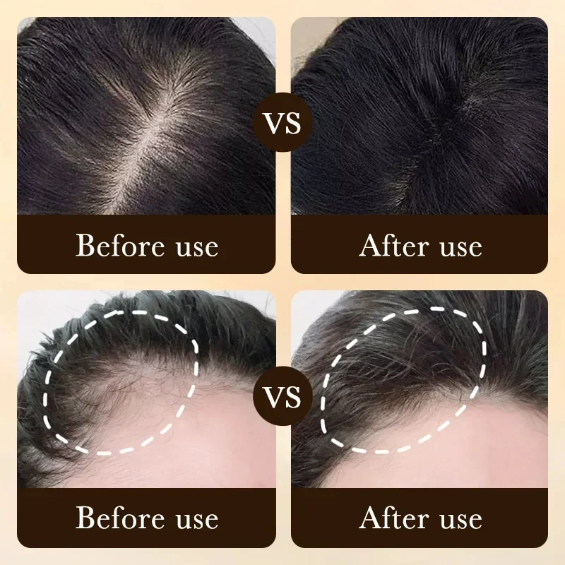 Biotin Fast Hair Growth Oil Pr - Hair Care Fragrance Essential Oil review and price