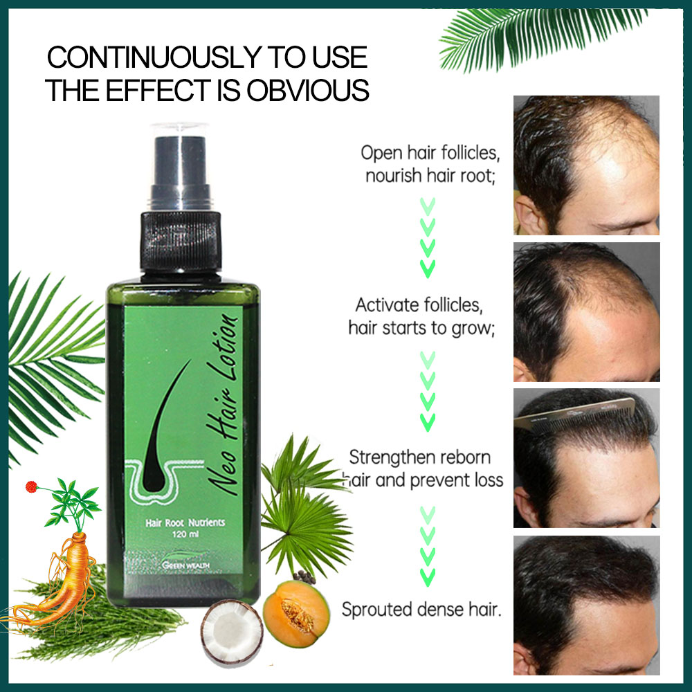 Original Neo Hair Lotion 120ml - Hair Care Thailand review and price