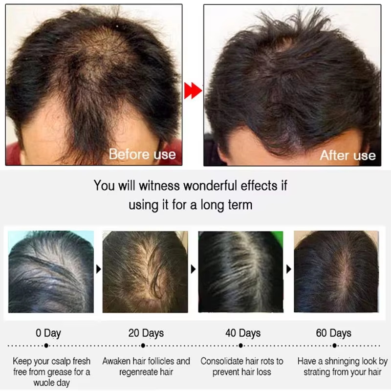 Fast Ginger Hair Growth Spray  - Hair Care Natural review and price