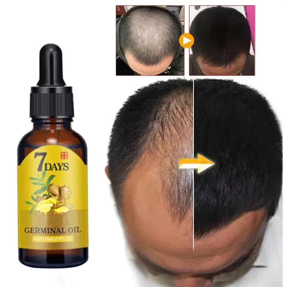Hair Growth Ginger Fast Growin - Hair Care Fragrance Essential Oil review and price