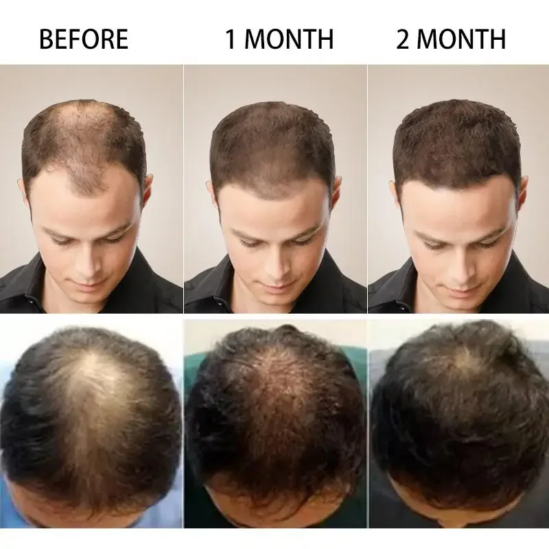 Hair Growth Ginger Fast Growin - Hair Care Fragrance Essential Oil review and price